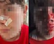 תושבת ראשון לציון ונכדתה בין נפגעי מתקפת התנים בכינרת: "הבילוי המשפחתי הפך לסיוט"